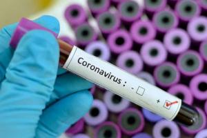 Україні загрожує розширення торговельного дефіциту через коронавірус